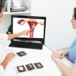How to treat Uterine Fibroids