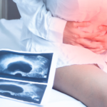 Ovarian cyst surgery